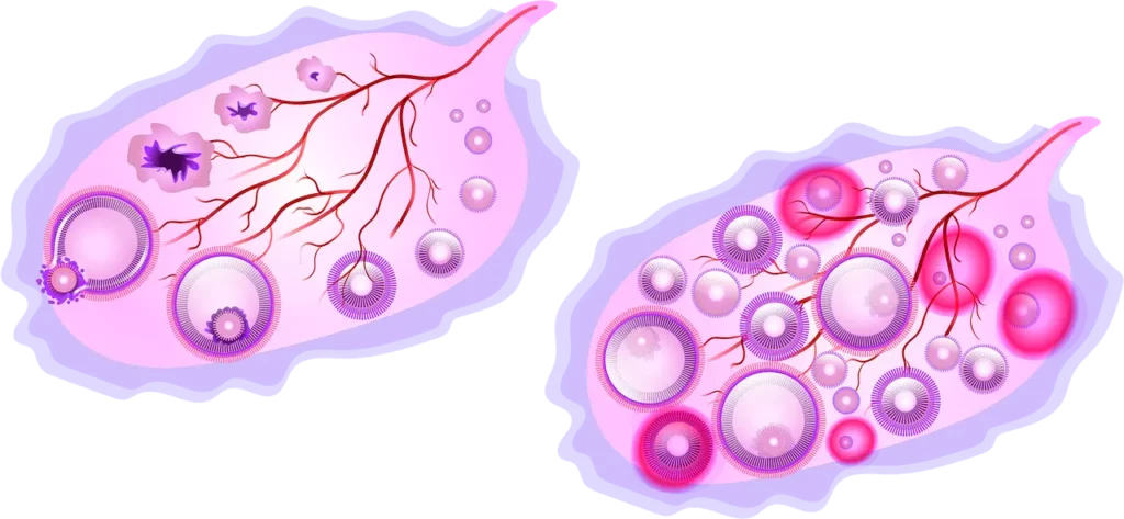 naturopathe ovulation